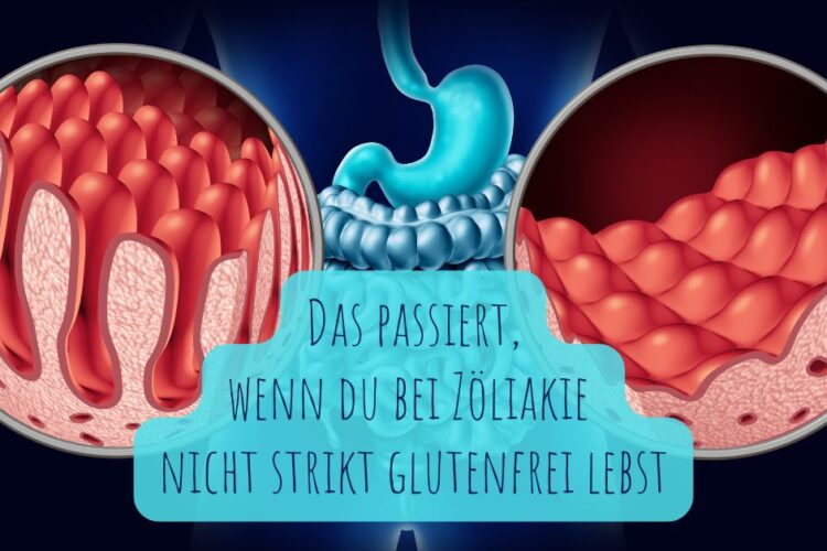 Zöliakie nicht ernst nehmen? Diese Folgen drohen